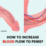 How to Increase Blood Flow to Penis?